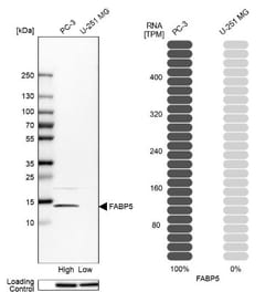 FABP5/E-FABP Antibody, Novus Biologicals 0.1mL; Unlabeled:Antibodies, Polyclonal